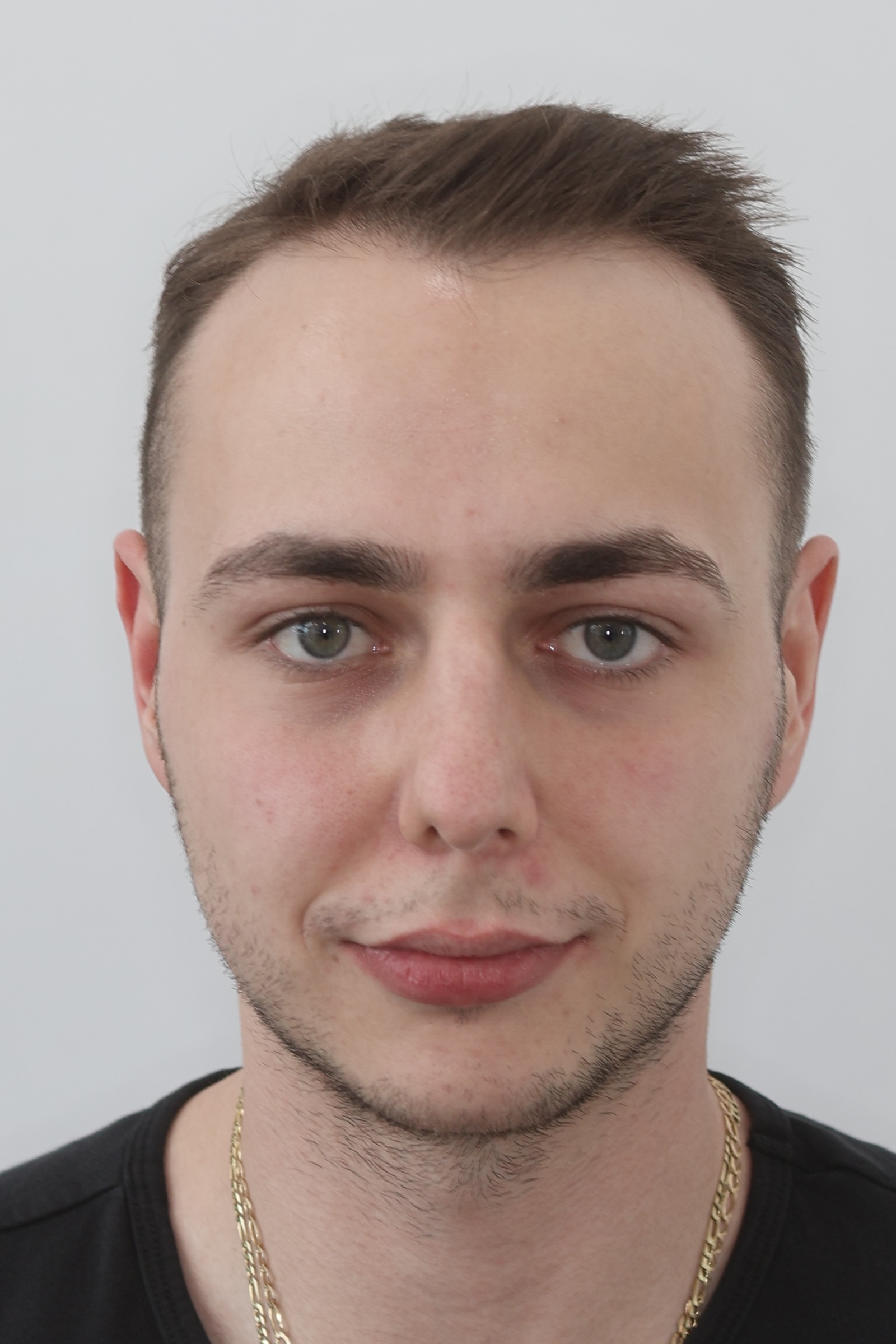 Extraorální snímek ořezaný a seřazený SmileCrop